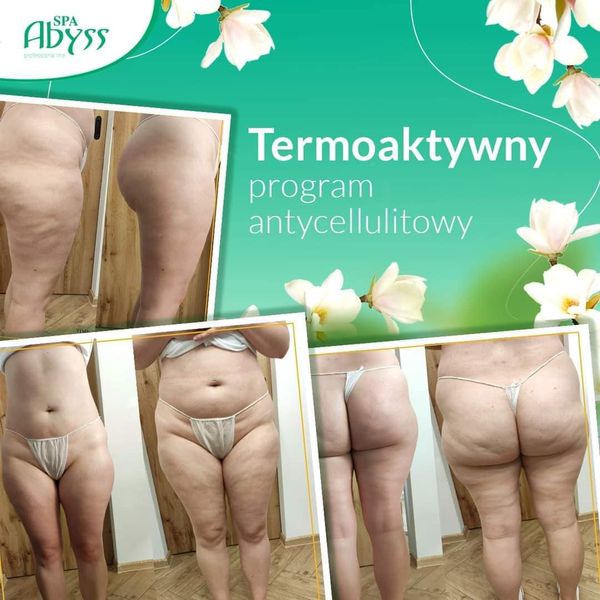 Termoaktywny Program Antycellulitowy